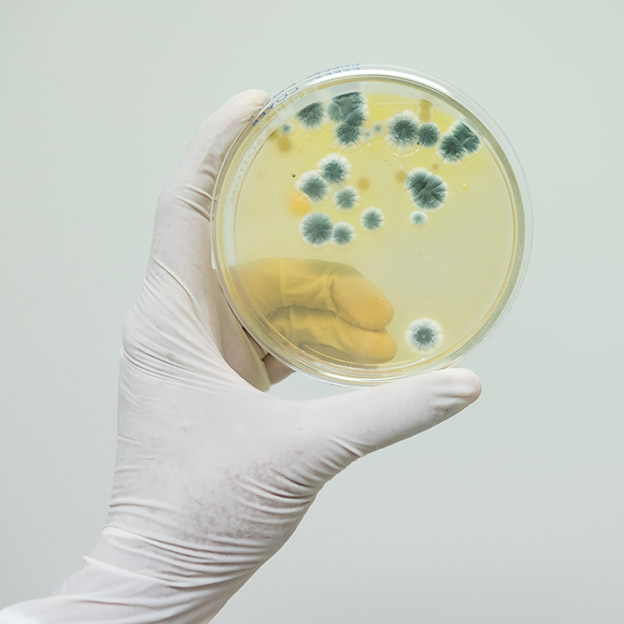 The,Microbiologist,Hand,Wear,White,Sterile,Glove,Is,Holding,The