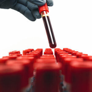 Test detección Herpes Virus